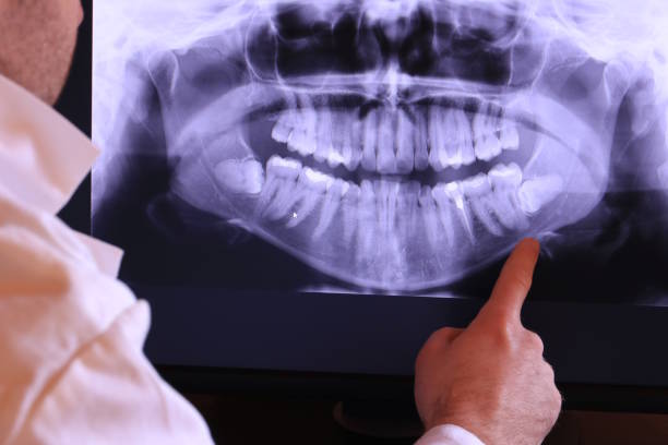 Best Urgent Care for Lost Fillings or Crowns in West Easton, PA