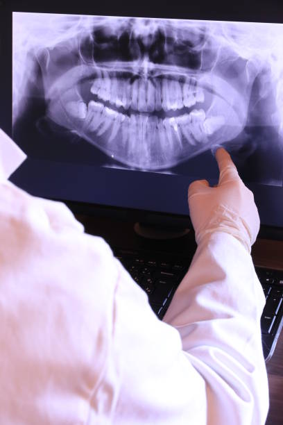 Best Emergency Treatment for Dental Infections or Abscesses in West Easton, PA